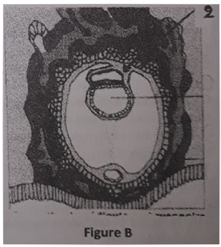 embryologie emd2 2018 ce 0007.png