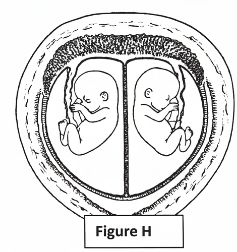 embryologie emd2 2018 ce 0001 nbp.png