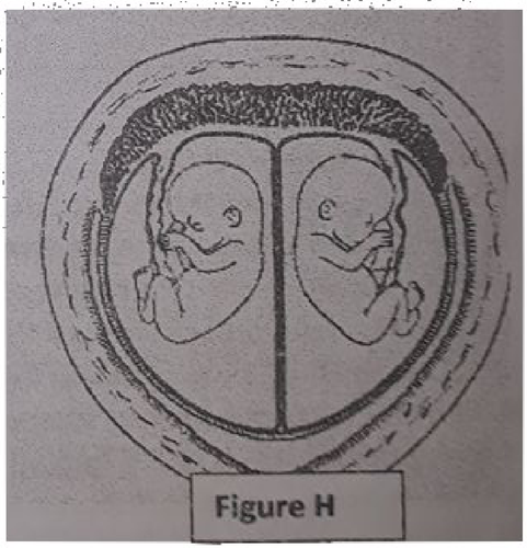 embryologie emd2 2018 ce 0001.png