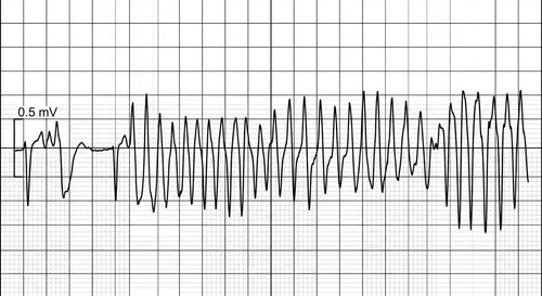 physio pathologie rattrapage 2016 ce 0001 nbp.jpg