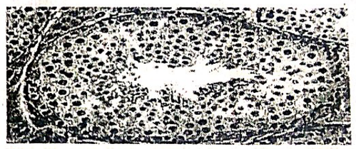 embryologie emd 2020 ce 0013.png