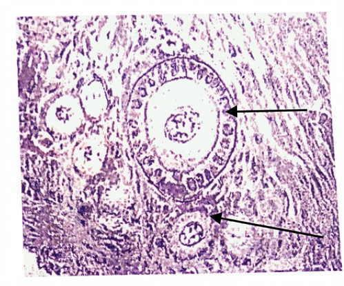 embryologie emd 2020 ce 0012 nbp.jpg