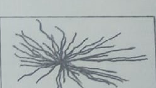 histologie emd2 2018 ce 0002.png