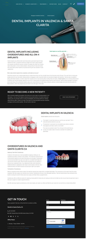 Affordable Dental Implants in Santa Clarita.png