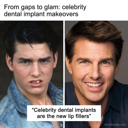 celebrity dental implant.jpg