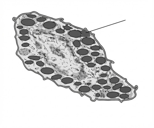 histologie emd1 2018 ce 0001 nbp.jpg