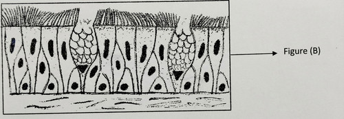 histologie emd1 2016 ce 0001 nbp.jpg