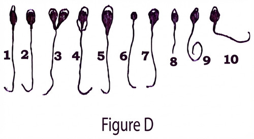 embryologie emd1 2018 ce 0001 nbp.jpg