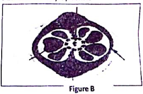 embryologie emd1 2018 ce 0003.png