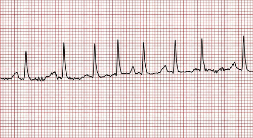 semiologie emd1 2013 ce 0001 nbp.jpg