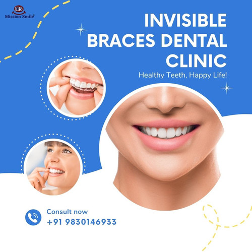 Trusted Invisible Braces Dental Clinic In Kolkata For Modern Orthodontics.jpg