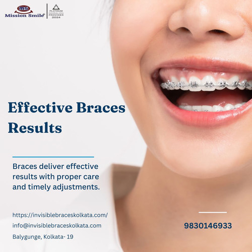 Tips for Faster and Effective Braces Results.jpg
