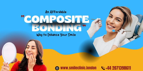 Composite Bonding An Affordable Way to Enhance Your Smile.jpg