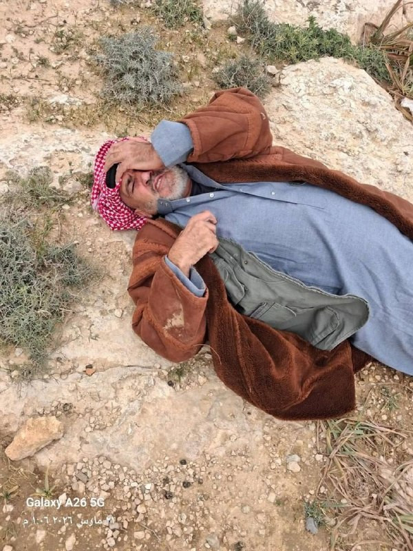 مصادر محلية: إصابة فلسطيني بعد اعتداء قطعان المستوطنين عليه خلال رعيه لأغنامه في منطقة حوارة في مسافر يطا جنوب الخليل اليوم...