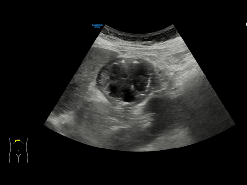 lbox 8356 stomach 1.png