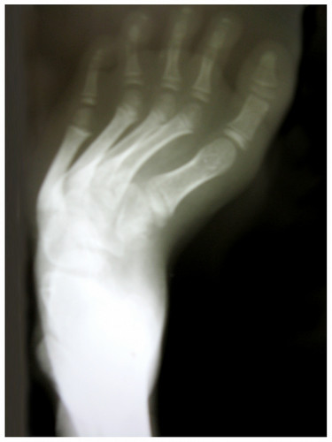 Advanced Foot & Ankle Surgery Services – Trishla Ortho.jpg