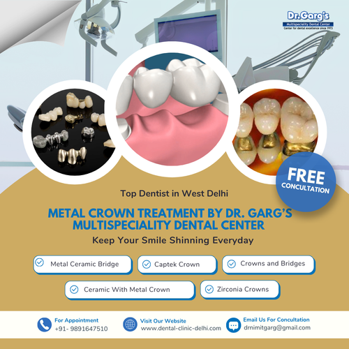 Metal Crown Treatment by Dr. Garg’s Multispeciality Dental Center | Top Dentist in West Delhi.png