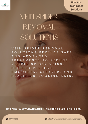 Vein Spider Removal Solutions (1).png