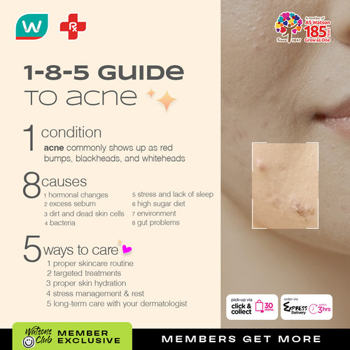 ACNE VIBER BASE.jpg
