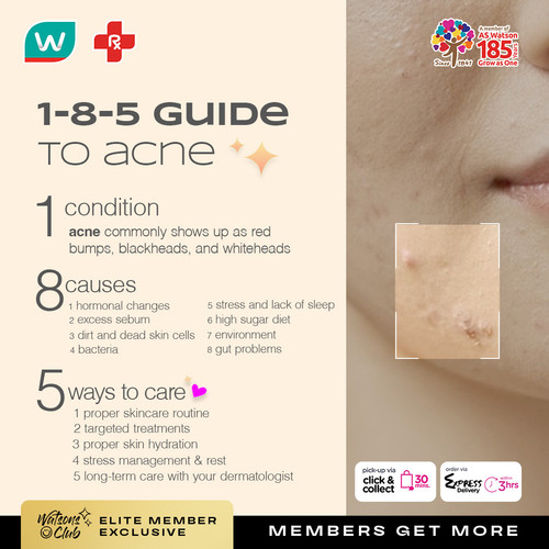 ACNE VIBER ELITE.jpg