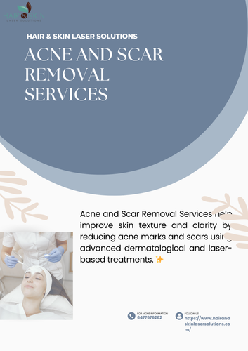 Acne and Scar Removal services (3).png