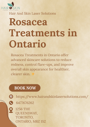 Rosacea Treatments in Ontario (1).png