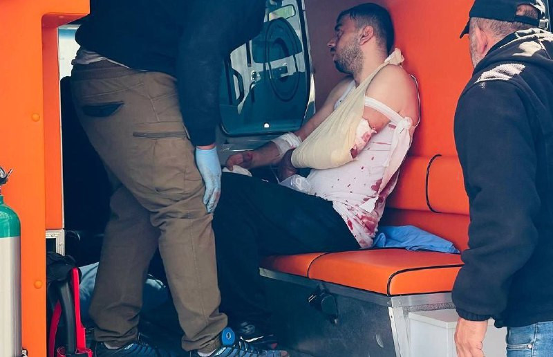 وصول إصابات جديدة إلى المشفى جراء هجوم مليشيات المستوطنين على قرية قريوت جنوب نابلس....