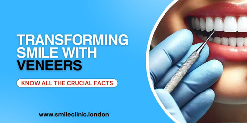 Transforming Smile with Veneers Know All the Crucial Facts.jpg
