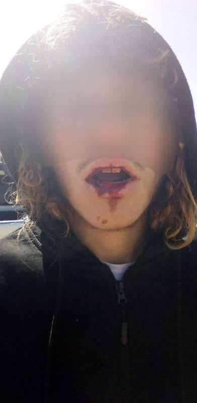 مصادر عبرية: إصابة مستوطن خلال مواجهات مع الفلسطينيين قرب قرية دوما شرق نابلس شمالي الضفة الغربية ظهر اليوم....