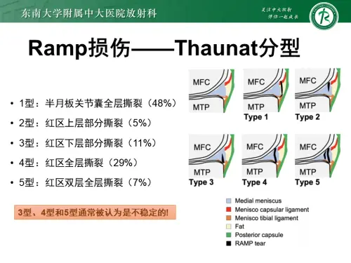 mmexport1772359671991.webp