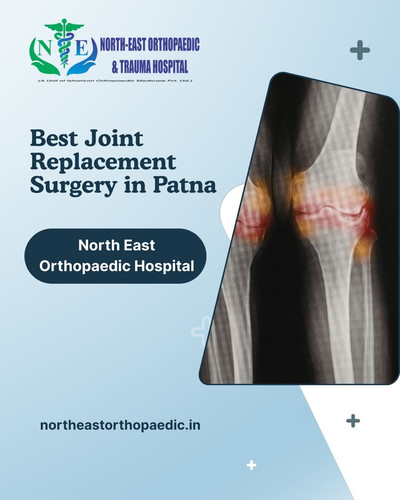 Best Joint Replacement Surgery in Patna: North East Orthopaedic Hospital.jpg