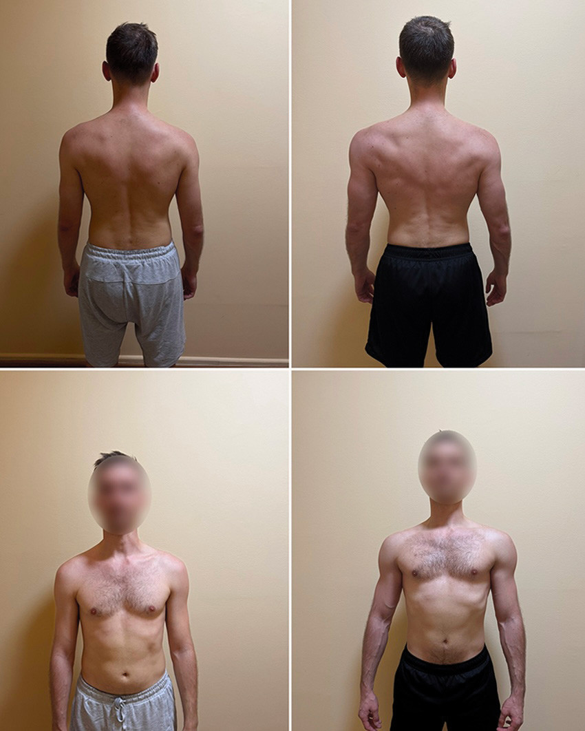 Результат клиента до / после