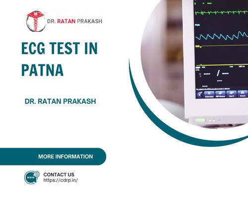 ECG Test in Patna: Dr. Ratan Prakash.jpg