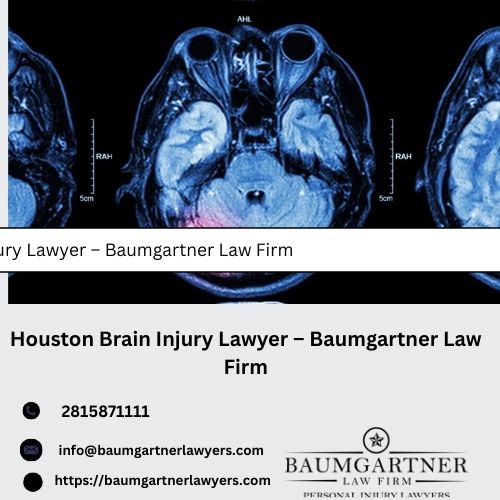 HoustonBrainInjuryLawyer–BaumgartnerLawFirm.jpg