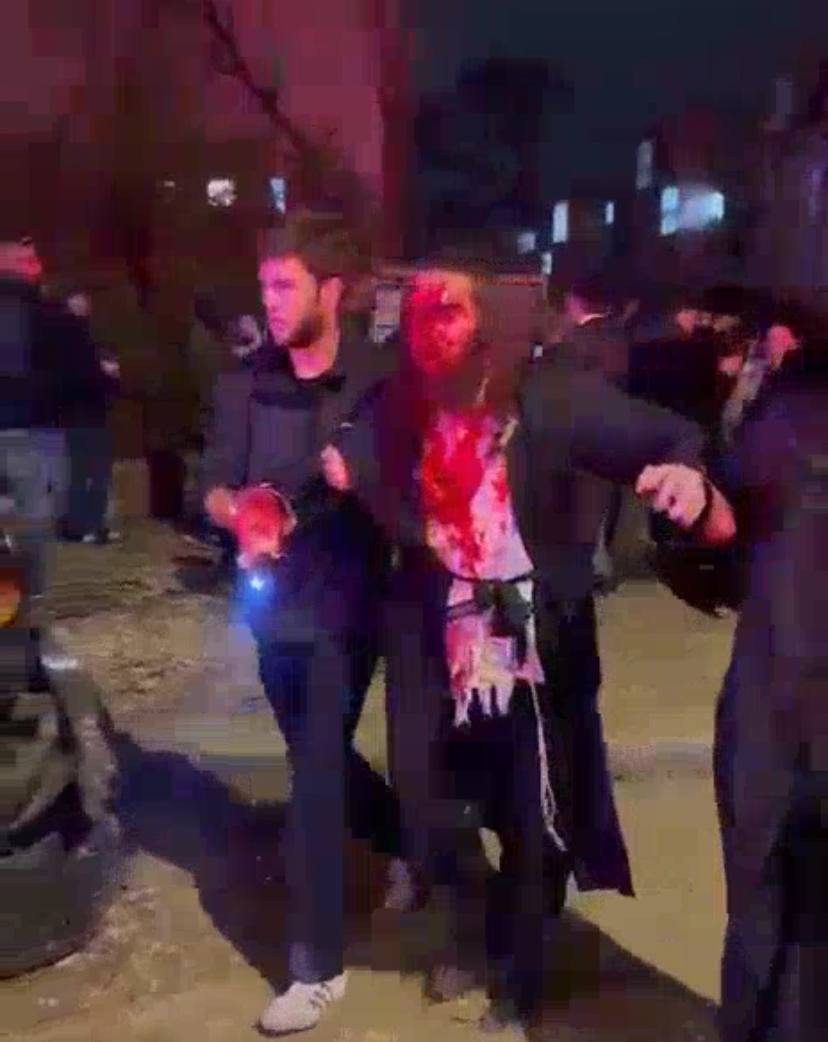 مستوطنون مدرجون بالدماء بعد إصابتهم بالقصف الإيراني في عراد...