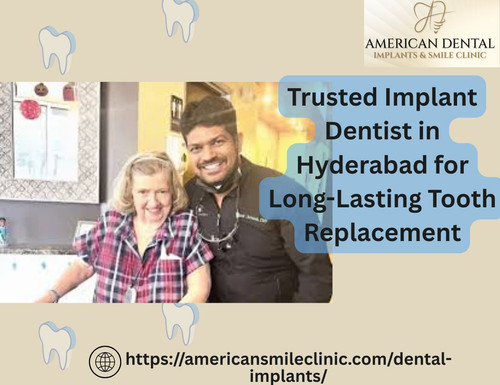 Trusted Implant Dentist in Hyderabad for Long Lasting Tooth Replacement.jpg