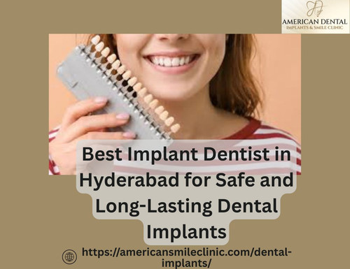 Best Implant Dentist in Hyderabad for Safe and Long Lasting Dental Implants.jpg