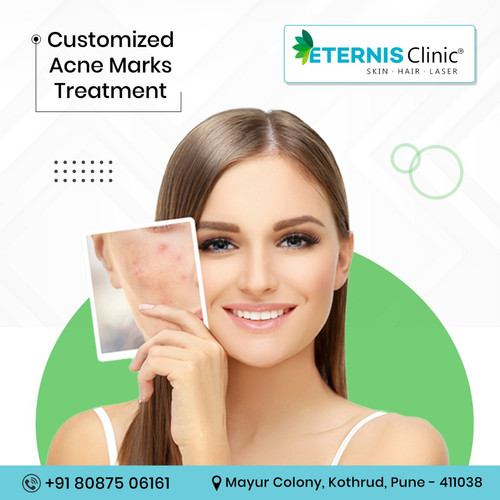 Skin specialist pune.jpg