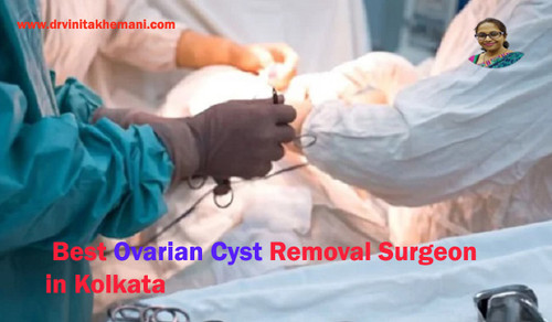 Dr. Vinita Khemani: Best Quality Ovarian Cyst Removal Surgery in Kolkata.jpg