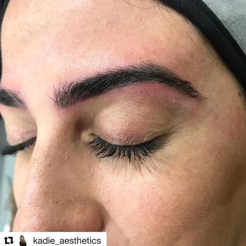 Breast Implants Boca Raton - Suria Plastic Surgery & Medspa (561) 338-3343.jpg