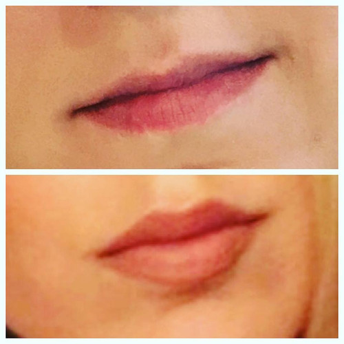 Suria Plastic Surgery & Medspa
595 S Federal Hwy #130
Boca Raton, FL 33432
(561) 338-3343

https://suriaplasticsurgery.com/fort-lauderdale/