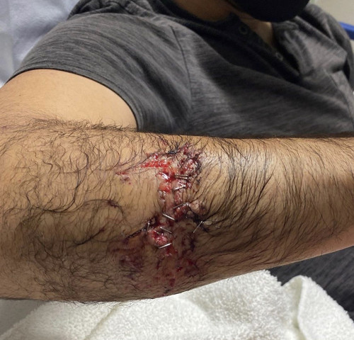 2662AA45 5245 43EC 99CE 3A88020CE816