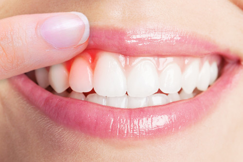 Gum Disease Specialist.jpg